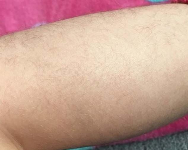 Женщина решила удалить волосы на ногах своей 6-летней дочери и ее поддержали многие матери